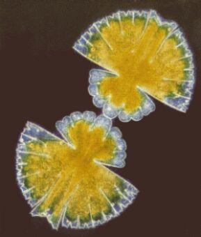 Micrasterias denticulata