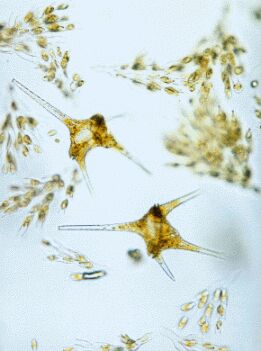 Dinoflagellaten und Goldalgen