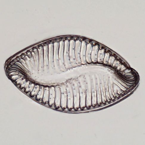 Surirella spiralis. Foto in Multilayer-Technik.